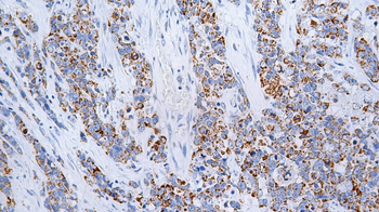 HIF-1α Antibody