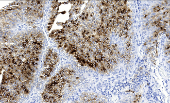 Uroplakin Ⅲ Antibody