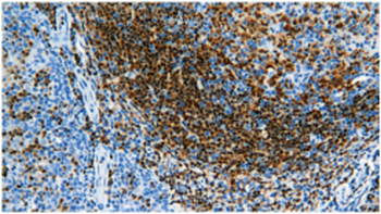 Pax-5 Antibody