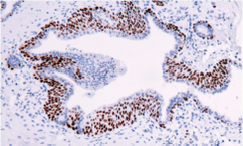 SMARCA2 Antibody