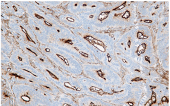 MDR-1 Antibody