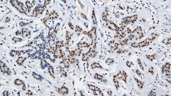 INI-1 Antibody