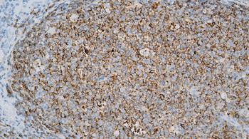 CD22 Antibody
