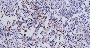 CD123 Antibody