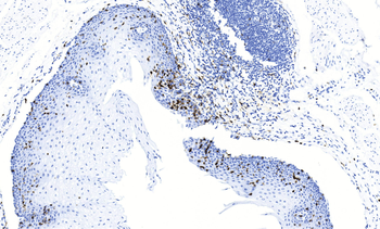 CD103 Antibody