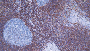 bcl-2 Antibody