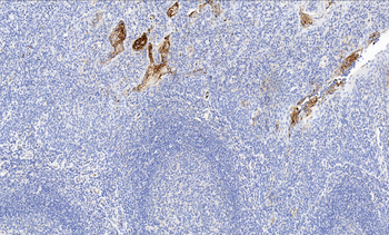 AAT Antibody