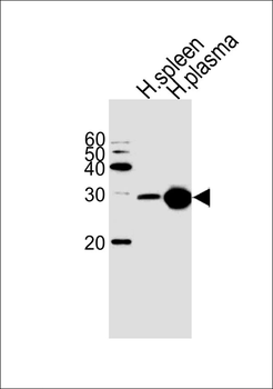 Serum amyloid P-component(1-203) Antibody (Center)