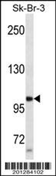 PGR/PR Antibody