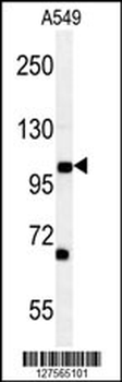 DPY19L2 Antibody (C-term)