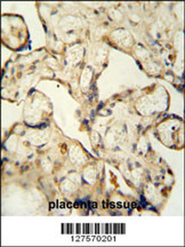 LCA5L Antibody (C-term)