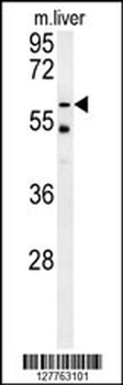 TYSND1 Antibody (C-term)