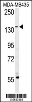 MUC1-T1224 Antibody