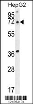 ACOT11 Antibody (C-term)