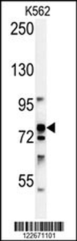 RPS6KA1 Antibody