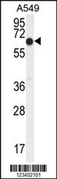 ELL Antibody (C-term)