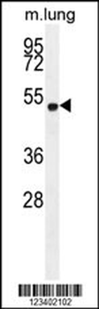 ELL Antibody (C-term)