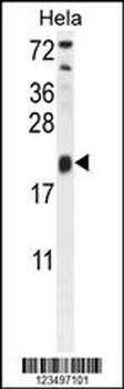 TRAPPC3 Antibody (N-term)
