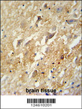 GABBR2 Antibody (C-term)