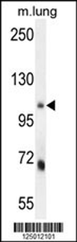 MLXIP Antibody (N-term)