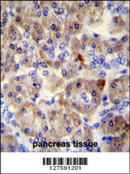 SPRED3 Antibody (N-term)