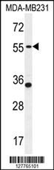PDE12 Antibody (C-term)