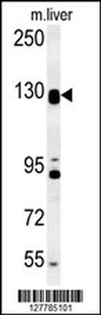 DENND5B Antibody (C-term)