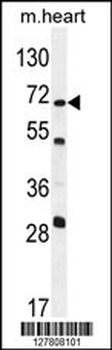 NT5C1B Antibody (N-term)