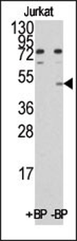 MINA Antibody (C-term)