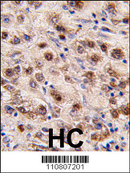 MINA Antibody (C-term)