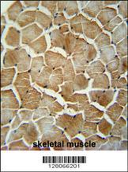 MRM1 Antibody (N-term)