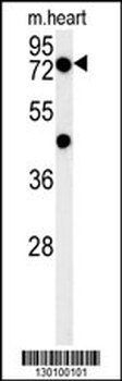 PHTF2 Antibody (Center)