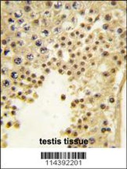 JHDM1a/FBXL11 Antibody (Center)