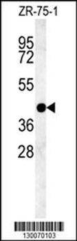 PSG9 Antibody (Center)