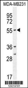 CYP2A7 Antibody (Center)