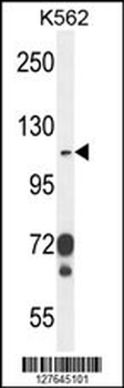 ITGAE Antibody (C-term)
