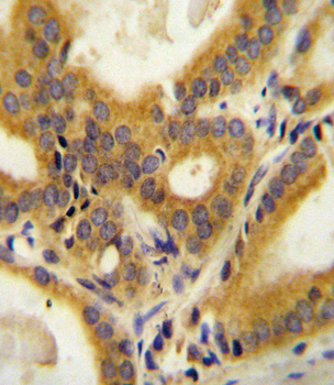 CC85C Antibody (N-term)