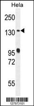 DEN5A Antibody (Center)