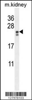 PIGX Antibody (N-term)