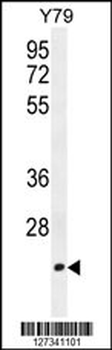 TCAL3 Antibody (N-term)