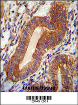 TPGS2 Antibody (Center)
