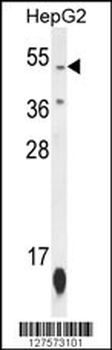ZNF566 Antibody (N-term)