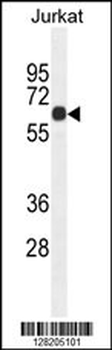 CCDC8 Antibody (C-term)
