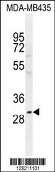 CLEC10A Antibody (N-term)