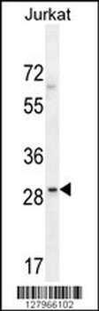 LRRC25 Antibody (C-term)