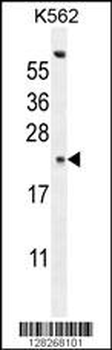 GAGE13 Antibody (N-term)
