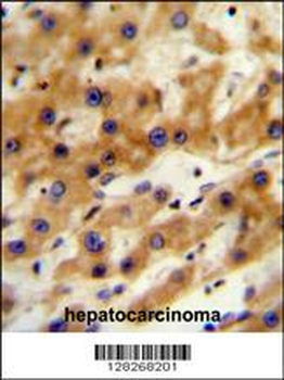 GAGE13 Antibody (N-term)