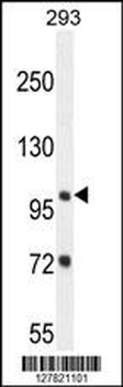 ZBTB10 Antibody (C-term)