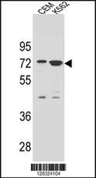 ZNF324B Antibody (C-term)