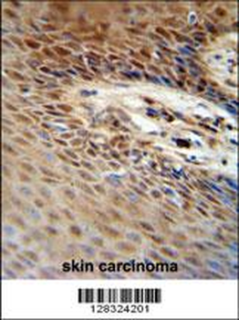 ZNF324B Antibody (C-term)